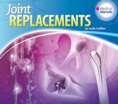 Joint Replacements (14)